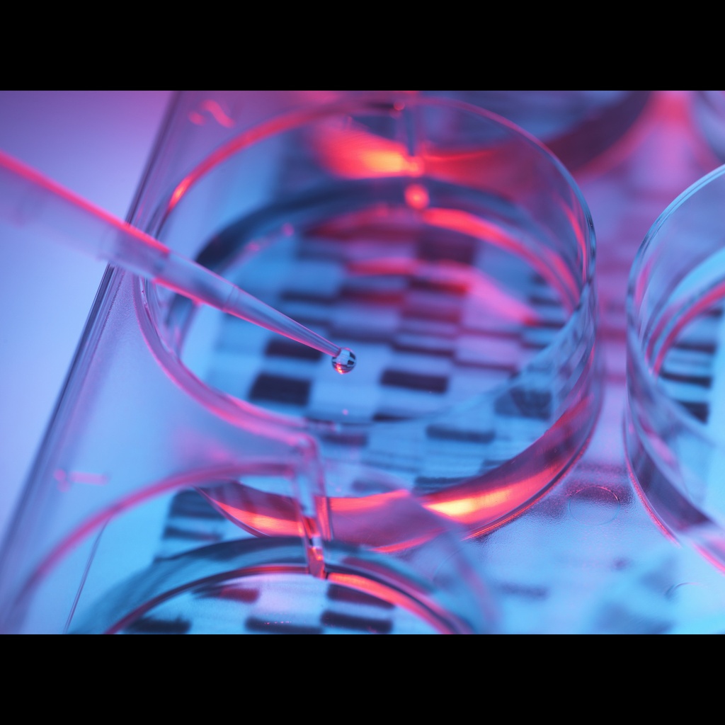 Amplirun® BK Virus DNA Control size: 10,000size:20,000 c/µL